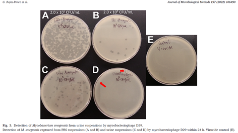Experimental urine recovery workflow for mycobacterial detection