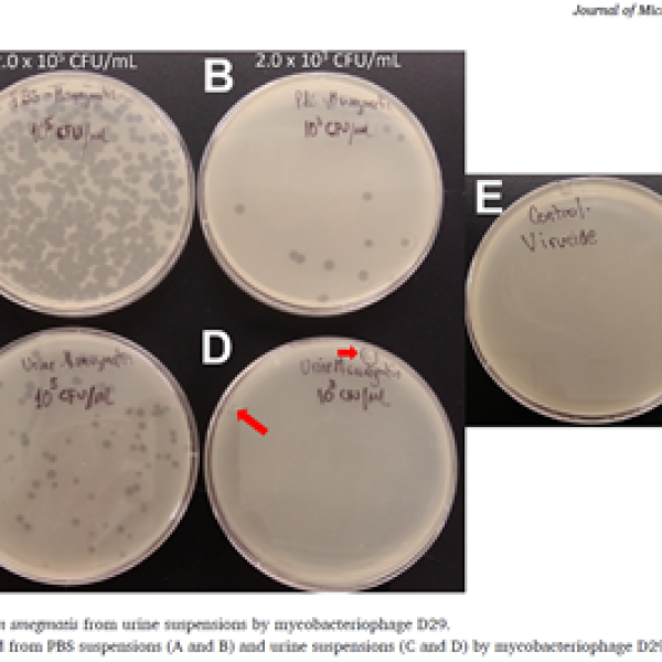 Experimental urine recovery workflow for mycobacterial detection
